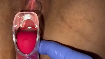 Gynecologist Uses Speculum To Induce Female Orgasm